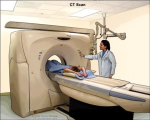 Conventional Medical CT
