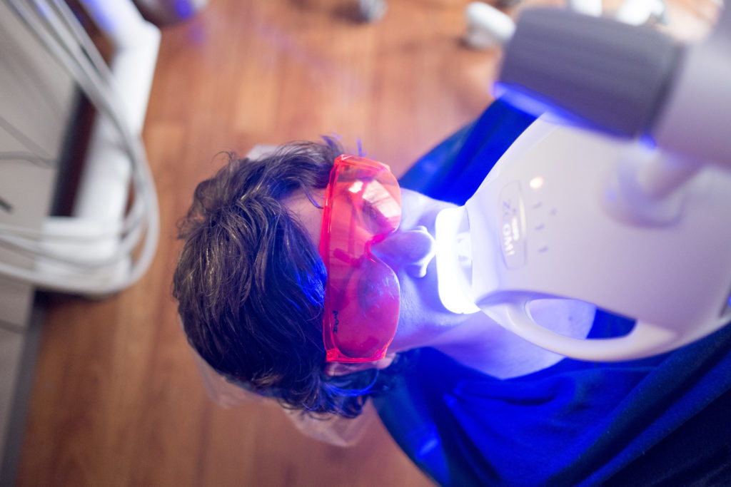 Teeth Whitening Andover