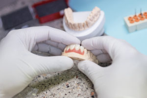 Candid Veneers Candid Veneers Tewksbury