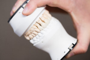 Dental Veneers Dental Veneers Billerica