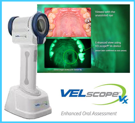 VELscope technology