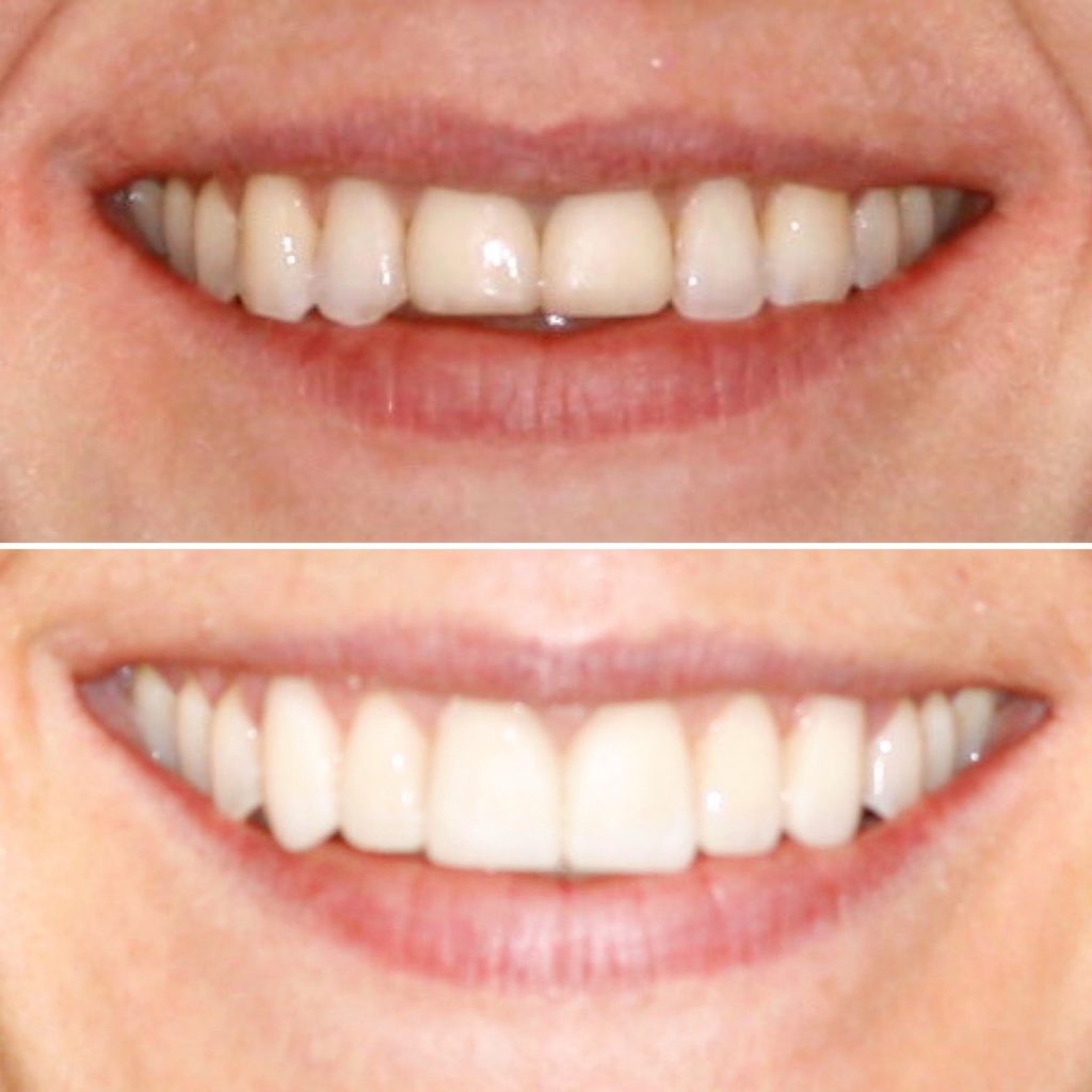 woman smiling straight at camera