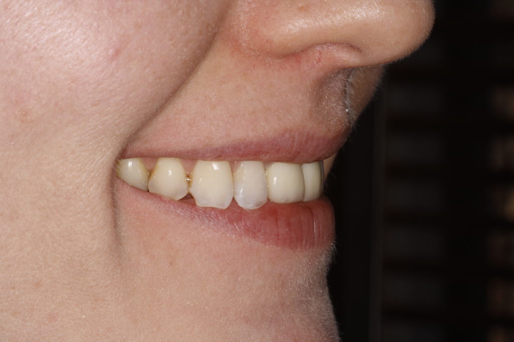 woman smiling at an angle