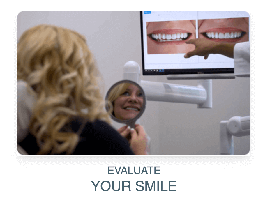 evaluate your smile