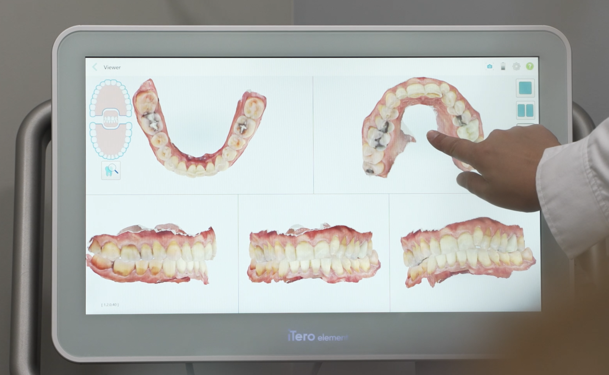 Make Your Invisalign Smile Last a Lifetime with Vivera Retainers Tewksbury Dental Associates